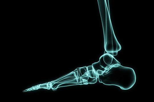 X-ray foot.
