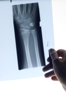 Woman holding x-ray photo