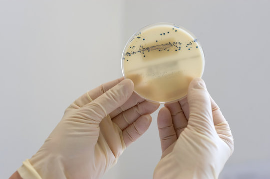Germany, Bacterial culture on petri dish