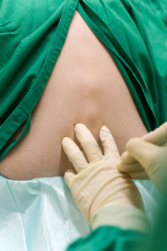 Germany, Close-up view of spinal anesthetic