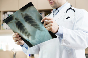 Doctor.Xray of lungs. hospital. medical check. 