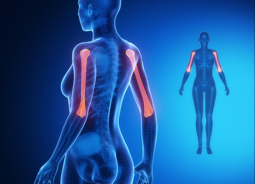 HUMERUS blue x--ray bone scan