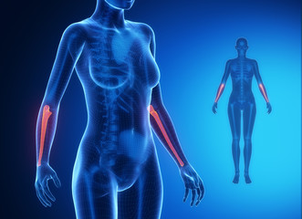 ULNA blue x--ray bone scan
