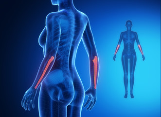 ULNA blue x--ray bone scan