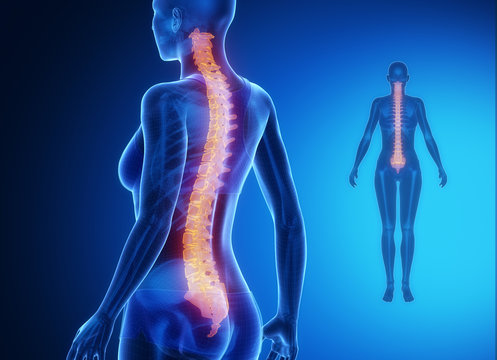 SPINE blue x--ray bone scan