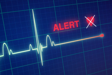 Heart beats cardiogram on the monitor.