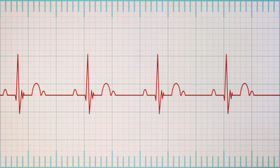 ECG / EKG monitor