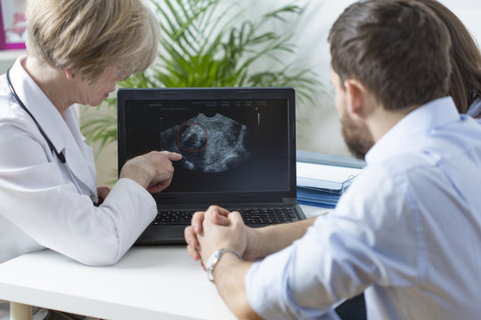 Showing fetus ultrasound