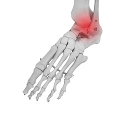 Heel and ankle pain, Pain concept.