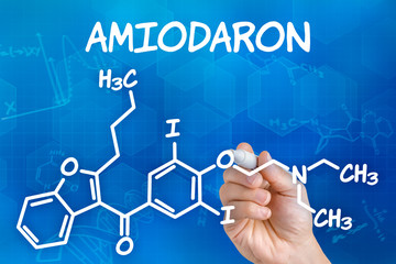 Hand mit Stift zeichnet chemische Strukturformel von Amiodaron
