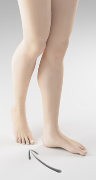 Gambe donna con piede destro indicato