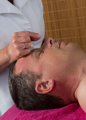 Obraz na płótnie Canvas Acupuncturist prepares to tap needle around face of man
