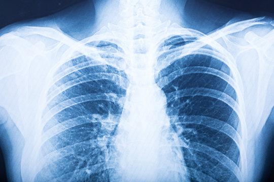 close up x-ray film
