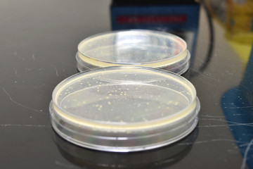 Many petri dishes with culture medium in laboratory.