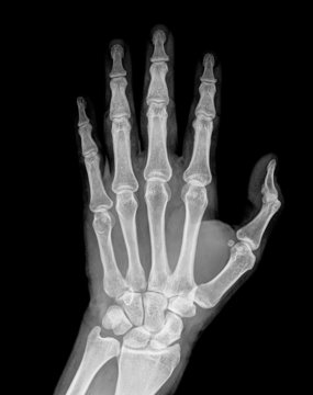 Hand xray image medical background