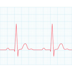 Medical electrocardiogram - ECG on grid