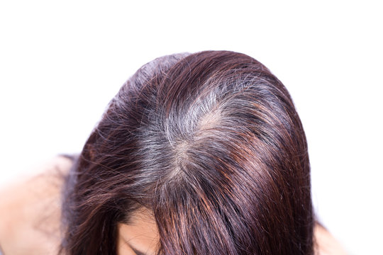 Young Woman Shows Her Gray Hair Roots