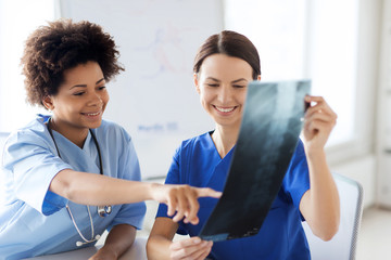 happy female doctors with x-ray image at hospital