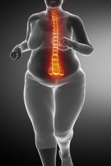 Fat woman with backache