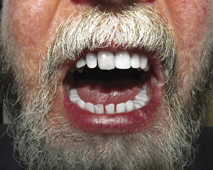Close up of face with beard and open mouth showing teeth and lip