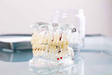 cast tooth