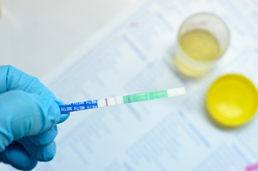 Urine analysis