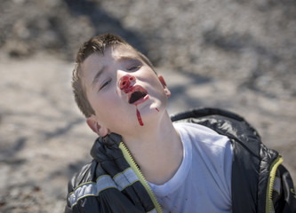 Boy ten years old with his nose bleeding after a conflict
