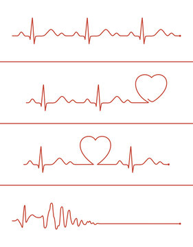 Set of various cardiogram lines. Cardiogram lines of healthy heart and heart stop