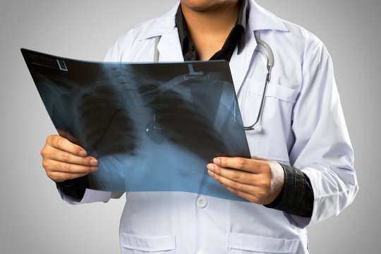 Close up of male doctor holding x-ray or roentgen image