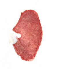 spot of blood on the white