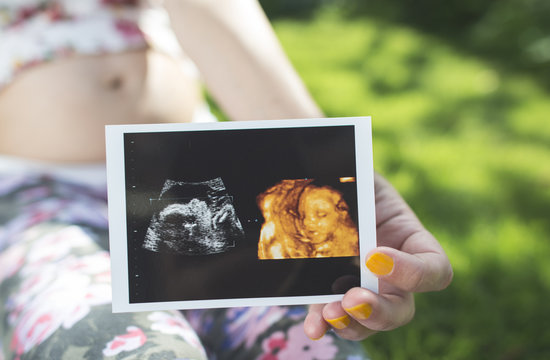 Pregnant women hold picture of womb