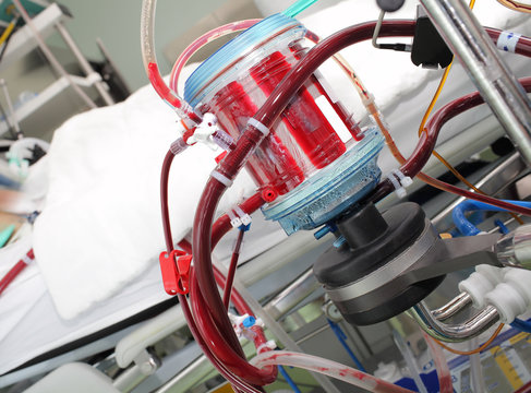 Modern equipment for oxygenation in a hospital at the patient's
