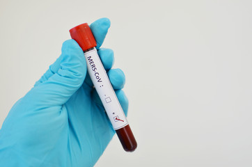 Naklejka premium MERS-CoV positive