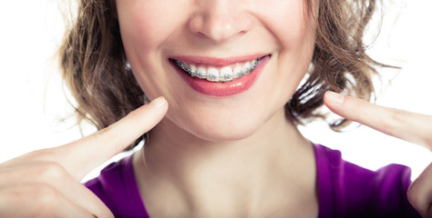 Beautiful smiling girl wearing braces.