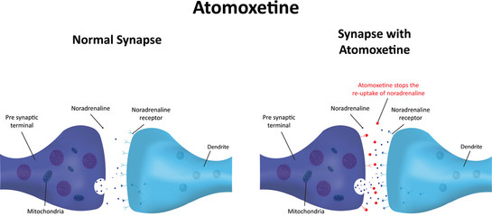 Atomoxetine