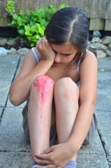 Mädchen mit Knieverletzung