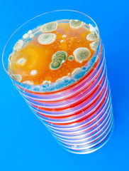 Petri dish with bacteria colonies
