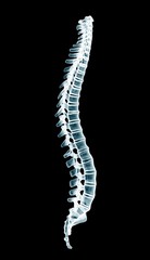 human spine isolated on a black background xray - 85087109