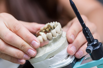 Zahnprothese in der Bearbeitung beim Zahntechniker