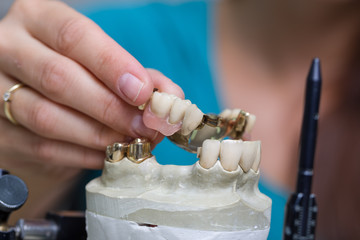 Zahnprothese in der Bearbeitung beim Zahntechniker