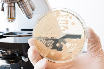 Laboratory doctor hand with gloves holding petri dish with bacteria. Laboratory microscope in the background
