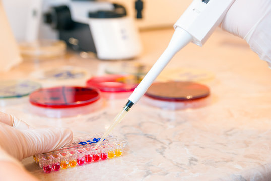 Laboratory doctor or scientific researcher using a pipette to take samples of infected urine with ureaplasma bacteria
