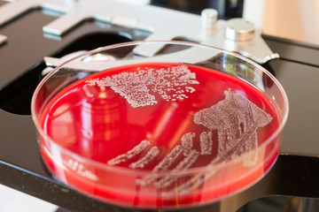 Bacteria colonies on petri dishes on microscope background