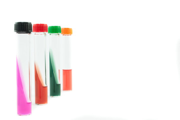 Urea agar base, citrate agar, triple sugar iron agar and motility urea indole medium on white background. Laboratory medicine equipment