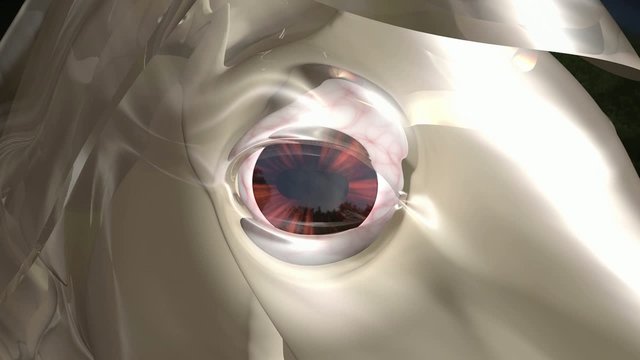 Detailed 3D medical animation showing equine recurrent uveitis.
Part2: several disorders of the eye