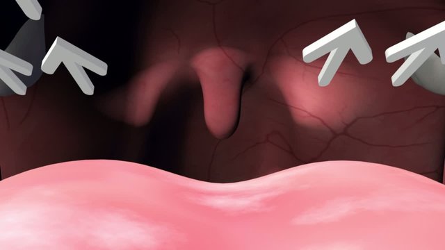 3D medical animation showing the anatomy of the human nose and explaining several reasons for snoring.
Part1