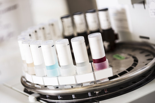Medical samples in tissue stainer