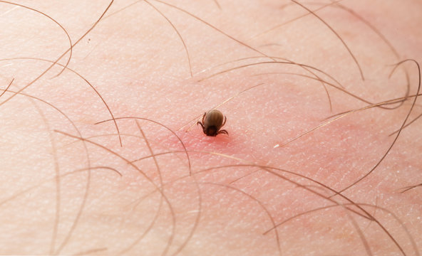 Tick