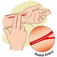 First Aid measuring pulse by Radial Artery