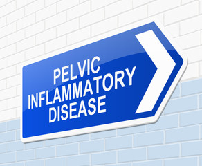 Pelvic inflammatory disease concept.